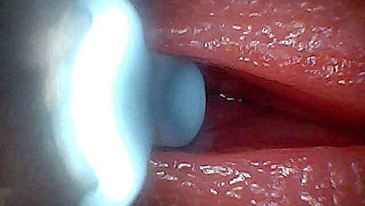 Inside Penis Sperm Journey Endoscopic Footage - Ladytwitti Amateur Cumshot Education